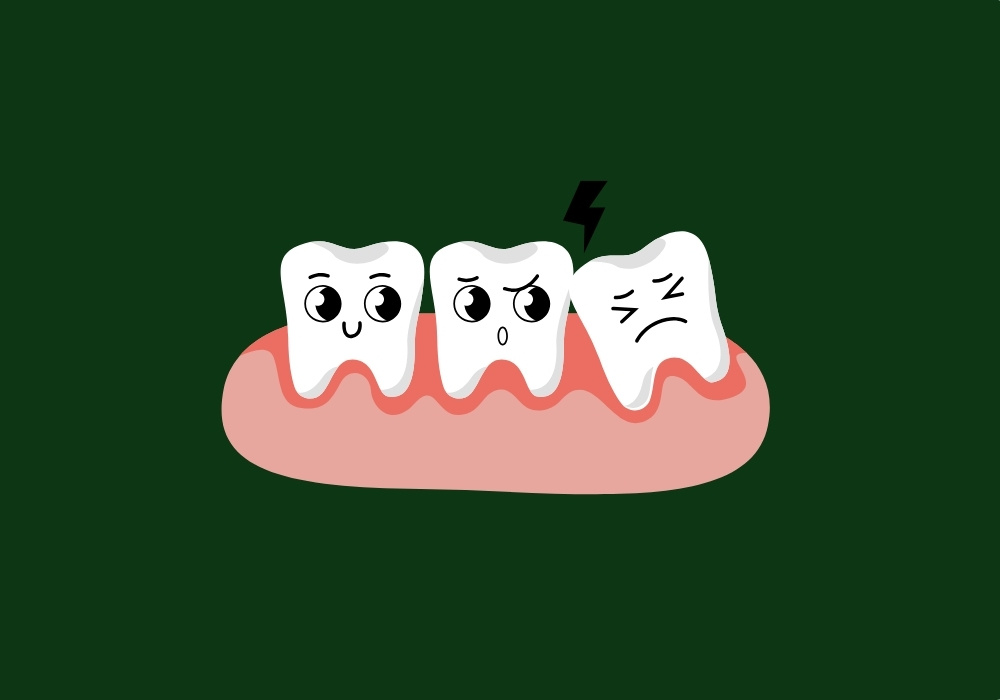 at what age do wisdom teeth come