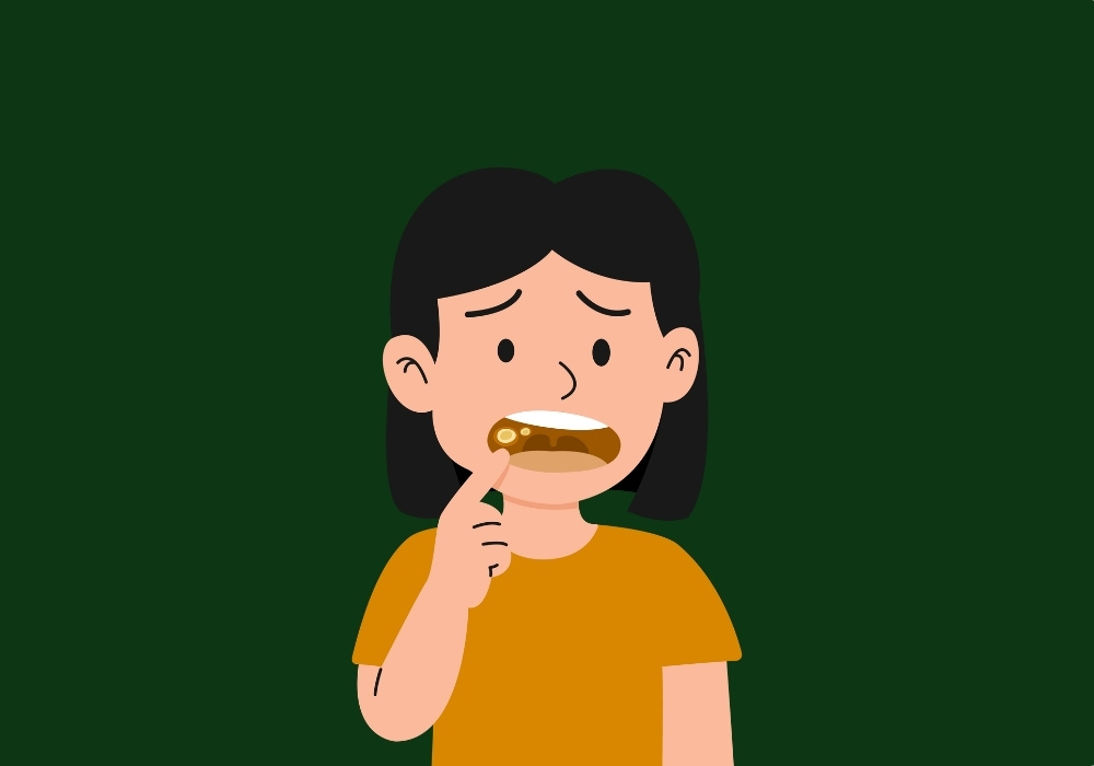 can wisdom teeth removal change the shape of your face