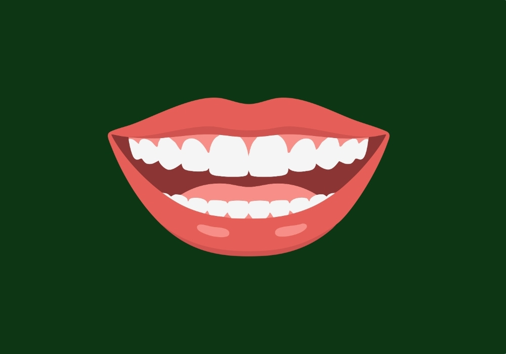 how long does teeth whitening last