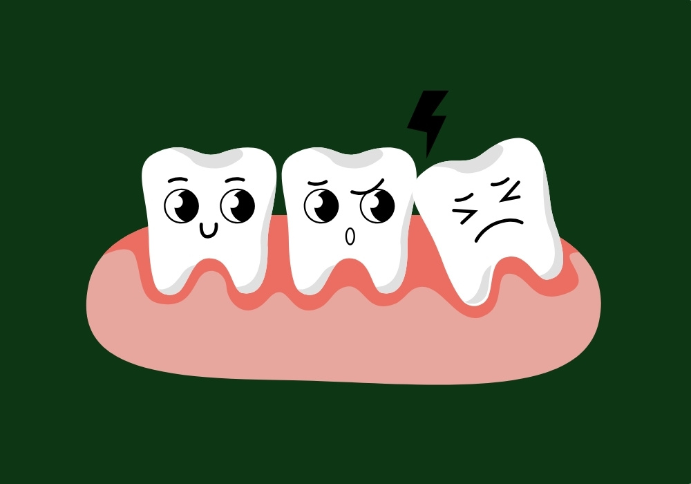 why are wisdom teeth called wisdom teeth
