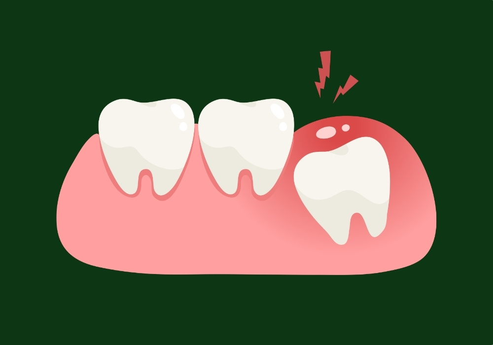 will wisdom tooth grow back