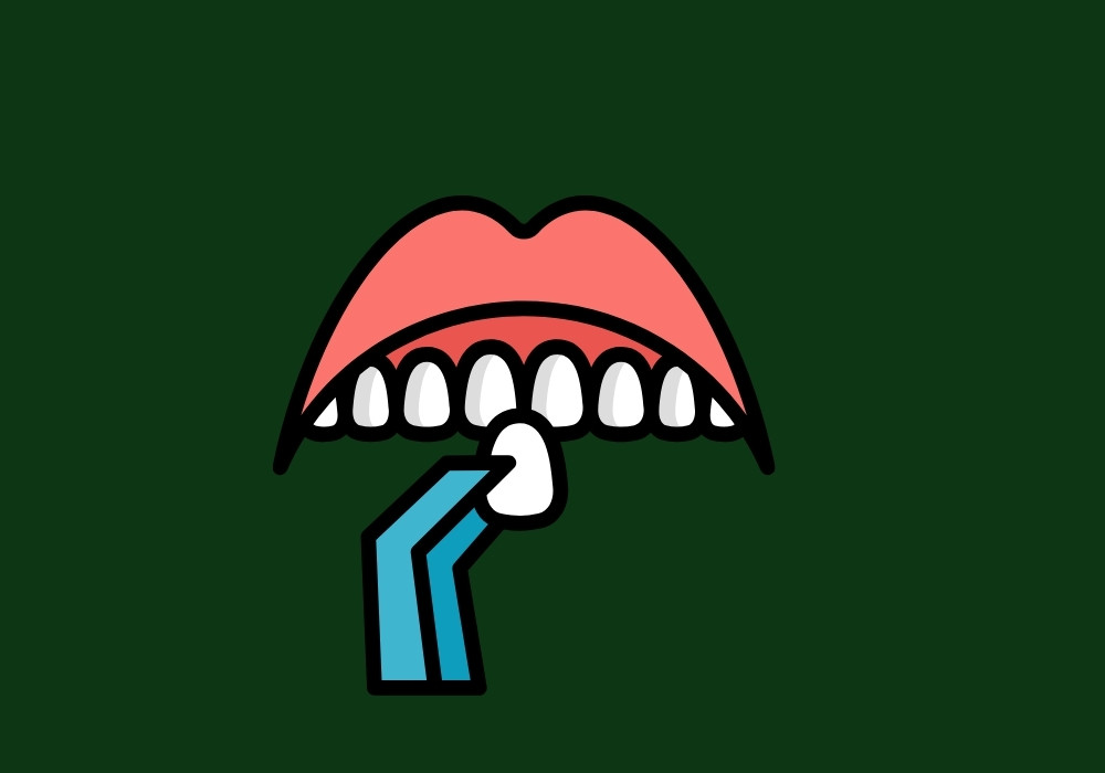 do composite veneers cover the whole tooth