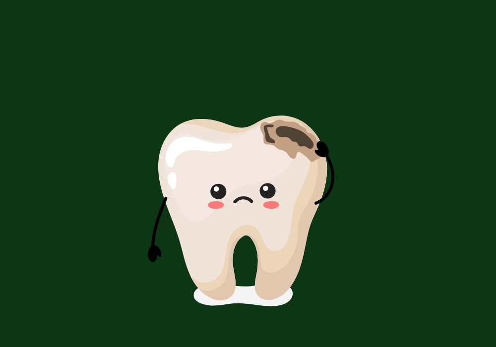 do veneers prevent tooth decay