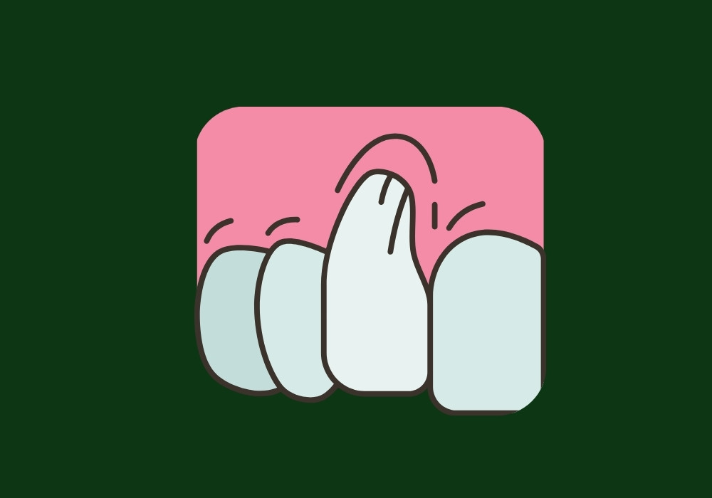 how to care for receding gums