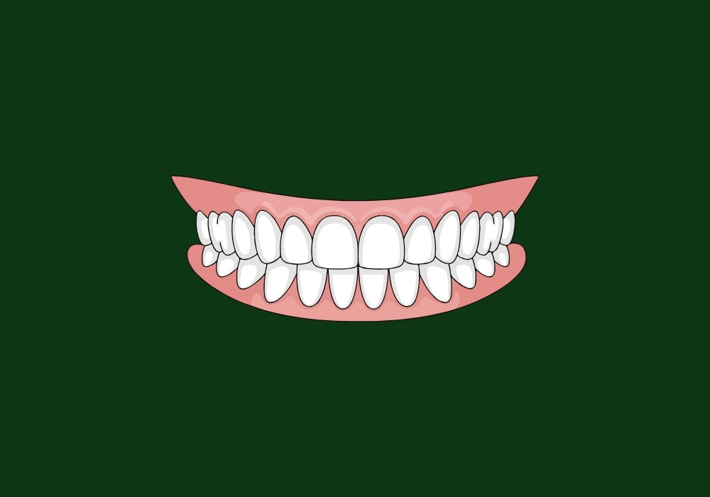 are my gums too low