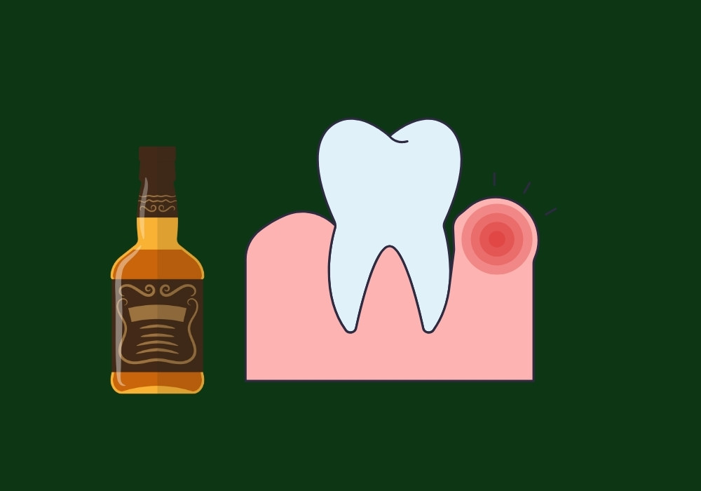 can alcohol cause gum inflammation