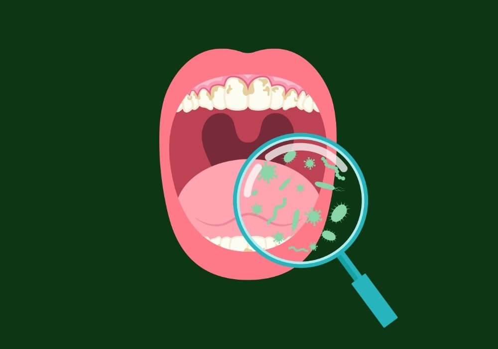 can gum disease cause a soar throat