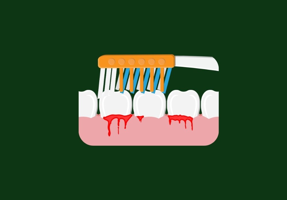 why do my gums bleed when i brush teeth