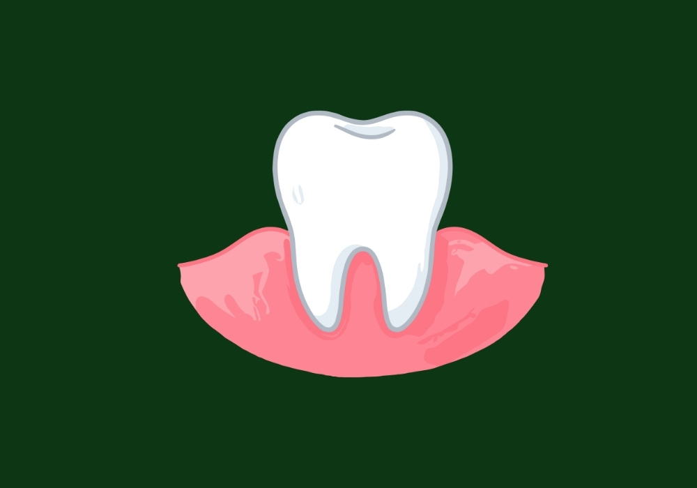 is it normal to be able to move your gums